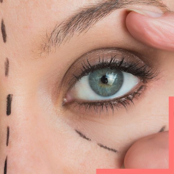 wide awake facelift