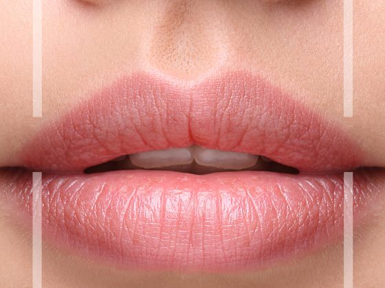 Kissable Lips – Ready for the Mistletoe this Christmas