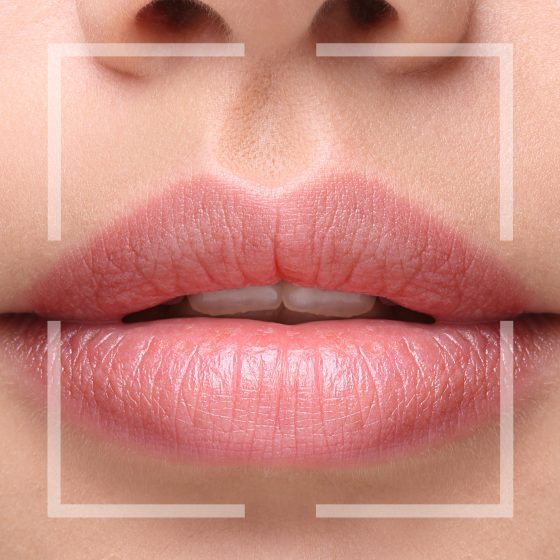 Kissable Lips – Ready for the Mistletoe this Christmas